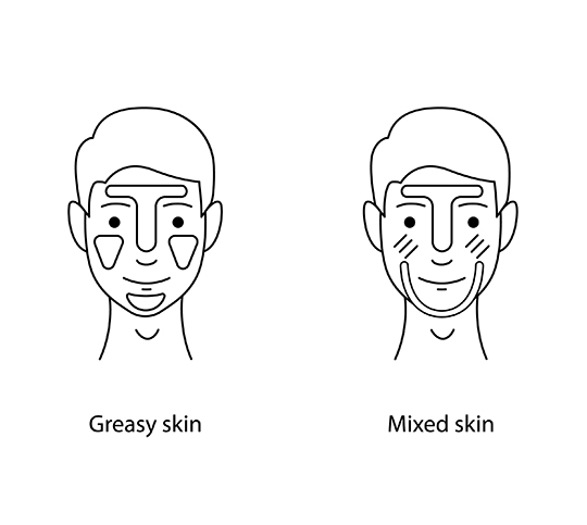 Differences between Greasy skin Mixed skin
